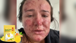 Hoygi โทนเนอร์แพด Kojic Acid Turmeric Cleansing Toner Pads โทนเนอร์แบบแผ่น Deep Cleansing Exfoliating ขจัดเซลล์ผิวที่ตายแล้ว ปรับปรุงผิวหยาบกร้าน ควบคุมความมัน ให้ความชุ่มชื้น ให้ความรู้สึกชุ่มชื้น และทำให้ผิวอ่อนนุ่ม