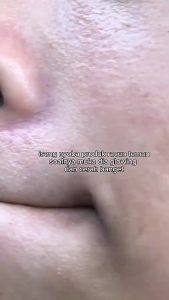 Sunflower serum Aleya herbal alami BPOM