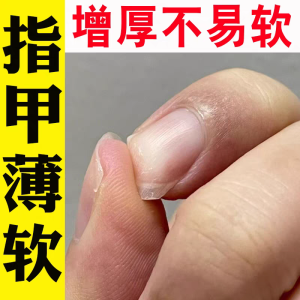 Quick Fix Thickening Hardening Nail Oil for Weak Thin Nails Prevents Splitting Protects Nails Enhances Nail Strength Beauty Tool