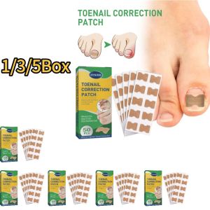 50/150/250pcs Nail Correction Stickers Ingrown Toenail Corrector Patch Waterproof Paronychia Treatment Recover Pedicure Tool