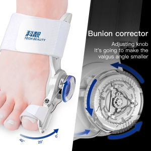 นิ้วเท้าใหญ่แก้ตาปลาบรรเทา - ลูกบิด ปรับได้ เครื่องยืด นิ้วเท้าหัวแม่ 1ชิ้น เครื่องมือ ดูแลเท้า