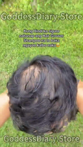 Minoxidil 5% Hair Grower Spray with Biotin Ginseng Darkening Spray Hair Loss Treatment