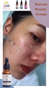 Aish Serum Acne Brightening Darkspot - Serum Membantu Wajah Glowing Mencerahkan Mengobati Jerawat dan Flek Hitam