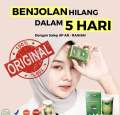 Salep Khusus Benjolan SP Ar raihan. 