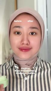 Reglow Rejuvenating Intensive Day Cream 100% Mencerahkan Wajah Glowing Cream Reglow Dr Shindy Penghilang Flek Hitam Cream Pelembab Wajah Reglow Penghilang Jerawat dan Bekas Jerawat Cream Siang Malam Glowing BPOM Menyamarkan Noda Hitam Bekas Jerawat