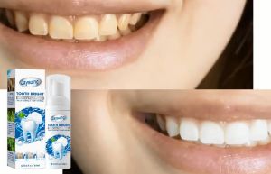 Jaysuing Teeth Whitening Mousse Dental Bleaching Reduce Yellowing Fresh Breath Stain 60ml