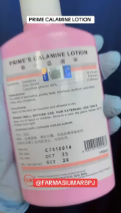 Prime Calamine Lotion (150ml bottle) SOOTHING SKIN/RUSHES/ITCHY SKIN