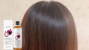 Red Onion Hair Growth Shampoo Against Hair Loss Products Strengthening Hair Follicle Lightweight Cinnamon Rosemary Oil Shampoo