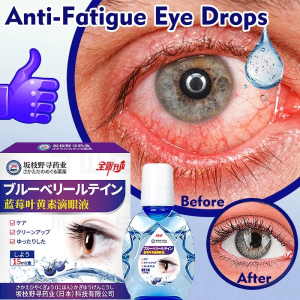 Japanese Eye drops Middle-aged and elderly cataract eye drops 15ml for dry eyes eyesight improvement red eyes itchy eyes/ dry eyes/ tired eyes eyes pain restore vision eye care