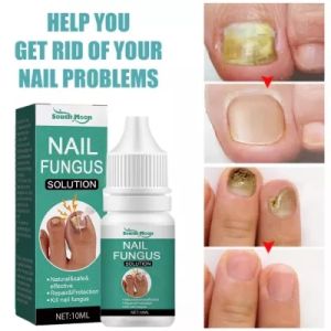 Obat Jamur Kuku Paling Ampuh Nail Repair Essence Serum Ajaib Viral Di Mengobati Kuku Berjamur Dan Rusak