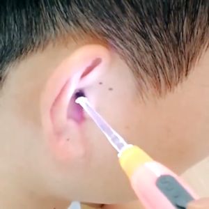 Sendok Penggali Telinga Kartun LED / Pembersih Telinga Senter