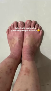 dr soap Nourishing Shower Gel Obsessions | Sabun Mandi Badan Jerawat Punggung & Kulit Eksim - Tanpa Sulfate & Alkohol