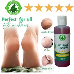 BRYELSS CARE 60ML CALLUS REMOVER SOLUTION WITH CALLUS PILE 1 SET(KALYO REMOVER/KALYO PEEL REMOVER)/Professional Dual Sided Hard Dead Skin Callus Remover Foot Rasp File Foot Care/⚡ Callus Remover Foot Care Cream For Cracks And Dry Cracked Heel⚡