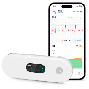 Portable AI-Powered ECG Monitor with 17-Event Detection OLED Display & Free App for Home Heart Health Tracking