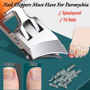 Essential Large Beveled Anti-Splash Nail Clippers for Paronychia Pointed Design Reaches Deep into Nail Groove
