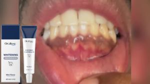 oralhoe | Oralhoe Whitening Toothpaste Powerful Cleaning Remove Stains Fresh Breath Gentle Non Irritating Mint Flavor Gum Care Toothpaste