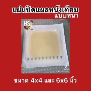 หนังเทียมปิดแผล แบบหนา ชนิดกดขอบ 2 ขนาด: P31