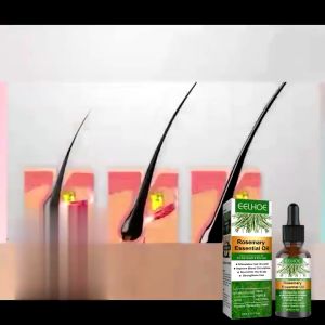 Minyak pati Rosemary essential oil for hair care Anti-frizz Growth Hairs Smooth Serum Hair Oil Nourish hair roots迷迭香护发精油