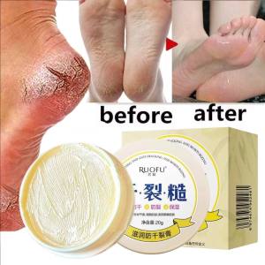 20g chống khô Kem bôi chân nứt gót chân loại bỏ Kem phục hồi da chết tay chăm sóc bàn chân Mặt nạ dưỡng ẩm chân