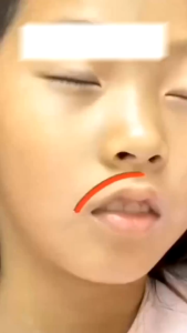 Miếng dán miệng khi ngủ hộp 30 miếng định hình miệng lọc không khí cho trẻ em và người lớn hỗ trợ ngủ ngon chống ngáy