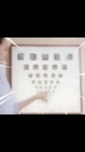 Lutein Eye Drops 15ml Treatment Dry Eyes Cataracts Blurry Vision tired eyes Red Eye of Eye Supplement