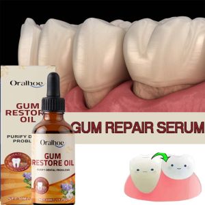 oralhoe | Fast Gum Repair Drops 7 Days Relieve Bleeding Sensitive Gums Soothe Inflammation Repair Gum Line Whiten Teeth Natural Oral Care