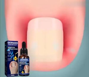 Tinh chất bôi nấm móng WEST&MONTH - Serum nấm móng