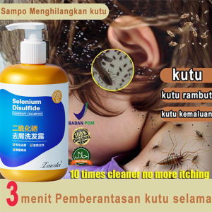 Selenium disulfida Sampo kutu rambut dan telur untuk anak dan dewasa Shampoo Anti ketombe 300ml