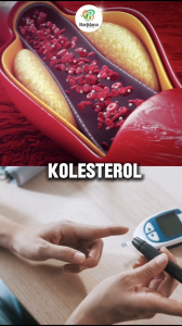 Kapsul Herbal VIOMAX Sambiloto Pemulihan Gejala ANOSMIA | Obat Wasir | Obat Ambeien | Stroke