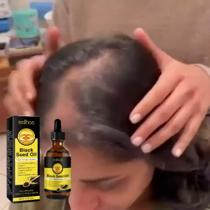 Eelhoe Black Seed Oil Essence Improves Dry And Frizzy Hair Nourishes And Repairs Damaged Hair Prevents Hair Loss And Makes Hair Thicker 60ml