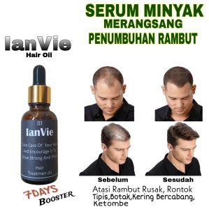 Serum Rambut kebotakan