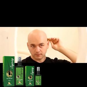 COD Jaysuing Ginger Hair Growth Spray Hair Regrowth Serum 120ml Natural anti-hair loss product Rapid hair growth Repair hair follicles Promote hair growth Suitable for men and women Green Ginger Hair Growth Spray
