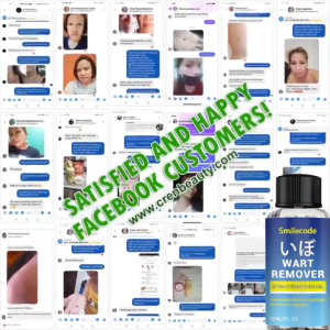 Japan Wart Remover ubat kutil removal for skin tag remover serum Moles and Genital Warts Ubat ketuat Painless removal 30ML 去疣精华