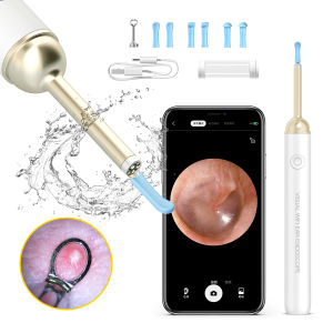 XIAOTIANLAI | Visual Ear Spoon High Definition Ear Cleaning Tool Childrens Special Glowing Ear Scrubbing Instrument Non-Disposable YYSD-2K