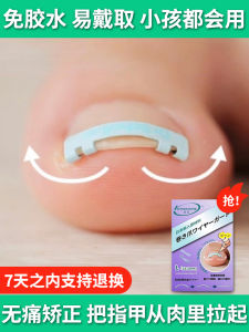 Onyxis Corrector Groove Corrector Toe Nail Groove Toe Nail Correction Handy Gadget Nail Buckle Special Inflammation Toenail Straightening Sticker