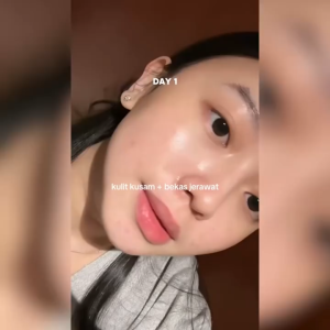 SKIN1004 Madagascar Centella Tone Brightening Capsule Ampoule