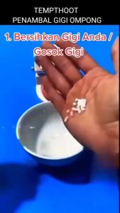 Penambal gigi 500 butir / Temporary tooth repair / temptooth / gigi pa