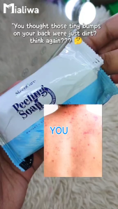 10 Pcs SkeenCare Peeling Soap 135g Sabon Pampaputi Exfoliating Moisturizing Face Body Wash Moisturizer Kojic Glycerin Acne Pimples Pores Pekas Melasma Peklat Scar Blemishes Wrinkles Dark Spots Hydrating Rejuvenating Beauty Glass Skin Care For Men & Women
