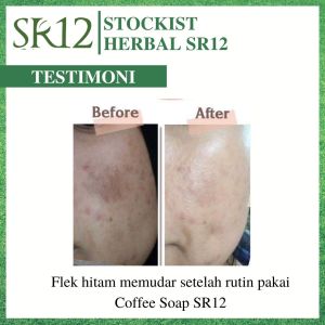 Sabun Kopi sr12 Ori / Sabun Plek Hitam Paling Ampuh / Penghilang Flek Hitam Paling Ampuh BPOM