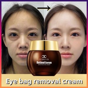 LYDIMOON Eye Cream 35g Instant Effective Eye Cream for Dark Circle Eyebag Remover Anti Aging Eye Cream Eye Mask Eye Serum for Black Circle and Eyebag Delays Aging Fades Wrinkles Firming Brighten Skin eye cream