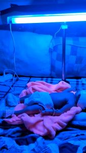 Đèn Chiếu Vàng Da Cho Trẻ Sơ Sinh TNC