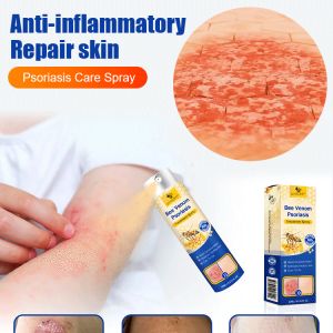 Psoriasis Treatment Spray Gentle Skin Care Spray Delicate Skin Topical Spray