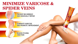 Kem Giảm Giãn Tĩnh Mạch Sumifun Varicose Veins 20g – Hết Sưng Đau Giảm Mỏi Làm Mát Da Dưỡng Chân