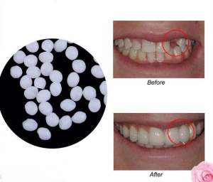 Gigi palsu diy gigi palsu sementara temporary tooth temptooth