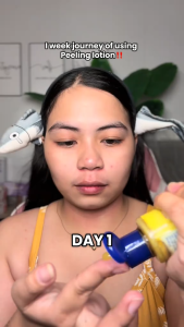 【BUY 1 TAKE 3】SkeenCare Peeling Lotion 100ml New Packaging (Best for Skin Care Regime)