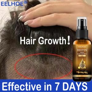7 days Hair Growth Spray Essence Hair Treatment Hair Tonic Conditioner Hair Anti Hair Loss Treatment Fast Promotes Hair Growth For man and woman 生发喷雾 30ML