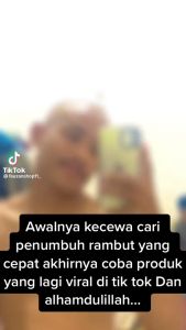 AL-QAHF - Penumbuh Jambang, Brewok, Kumis, Minoxidil, Rambut, Bulu, Botak Aman BPOM