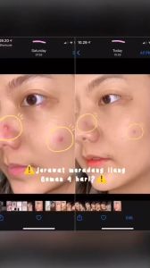 Implora Serum Wajah All Varian: Pilihan Terbaik untuk Semua Jenis Kulit