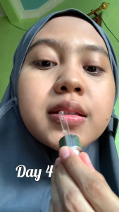 10ml Advance Lip Serum with Vitamin C dan Duo Vitamin E  Pencerah Bibir Eksfoliasi serta Melembapkan Bibir dengan UV Protection