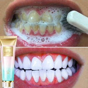 XOERMIOY toothpaste pemutih gigi kuning teeth whitening tiktok hot sale ubat gigi pemutih tartar remover ubat gigi untuk putihkan gigi fresh breath whitening toothpaste美白牙膏 Xoermi Oy - Lazada